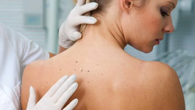 Skin Specialists Skin Specialists in Chandigarh