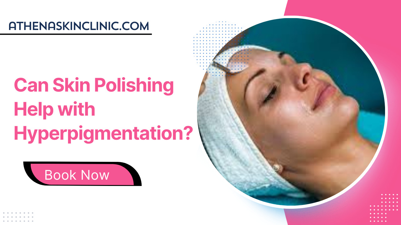 can skin polishing help with hyperpigmentation