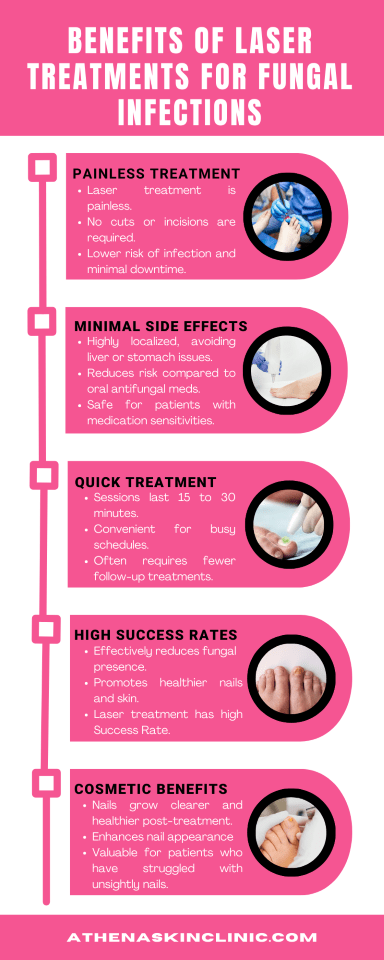 benefits of laser treaatment for fungal infection infographic