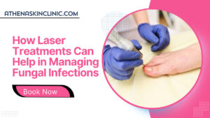 how laser treatment can help in managing fungal infections