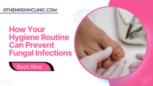 how-your-hygiene-routine-can-prevent-fungal-infections