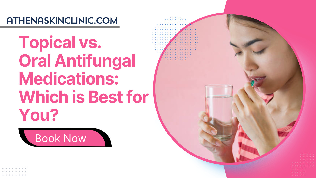 topical vs oral medication for fungal treatment