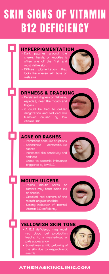 Skin Signs of Vitamin