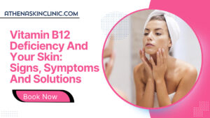 Vitamin B12