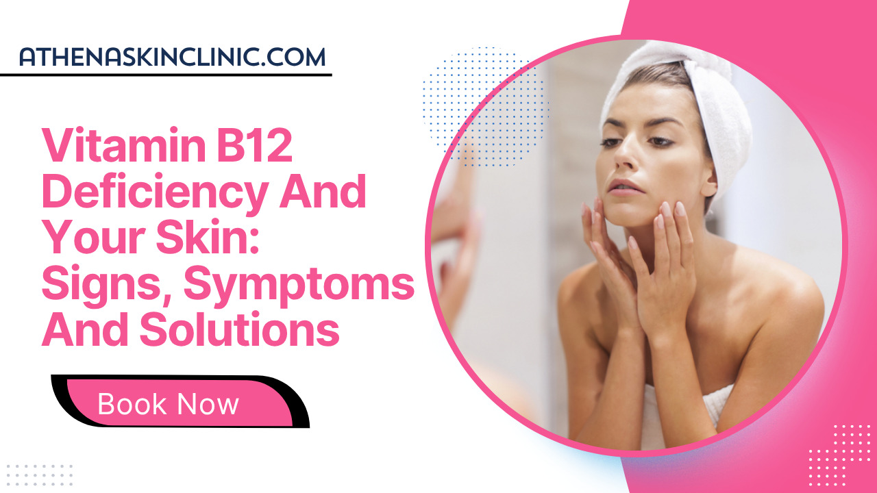 Vitamin B12