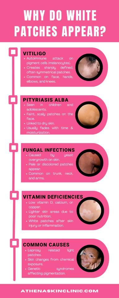 why do white patches content graphic