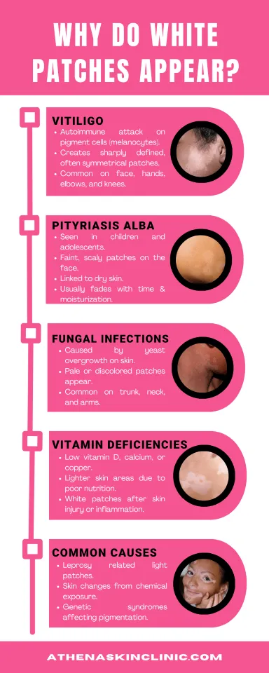 why do white patches content graphic