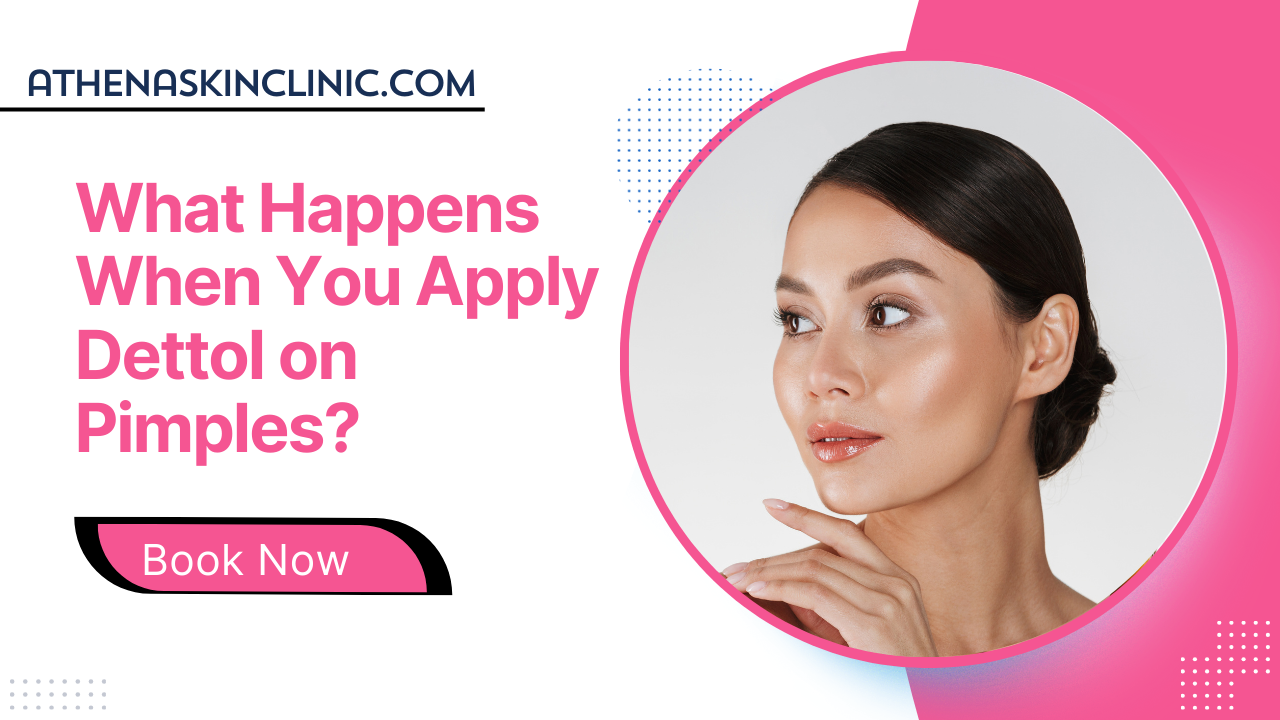 what happens when you apply dettol on pimples