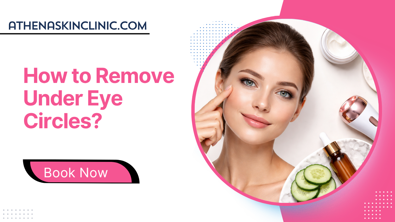 how-to-remove-under-eye-circle-feaured-image