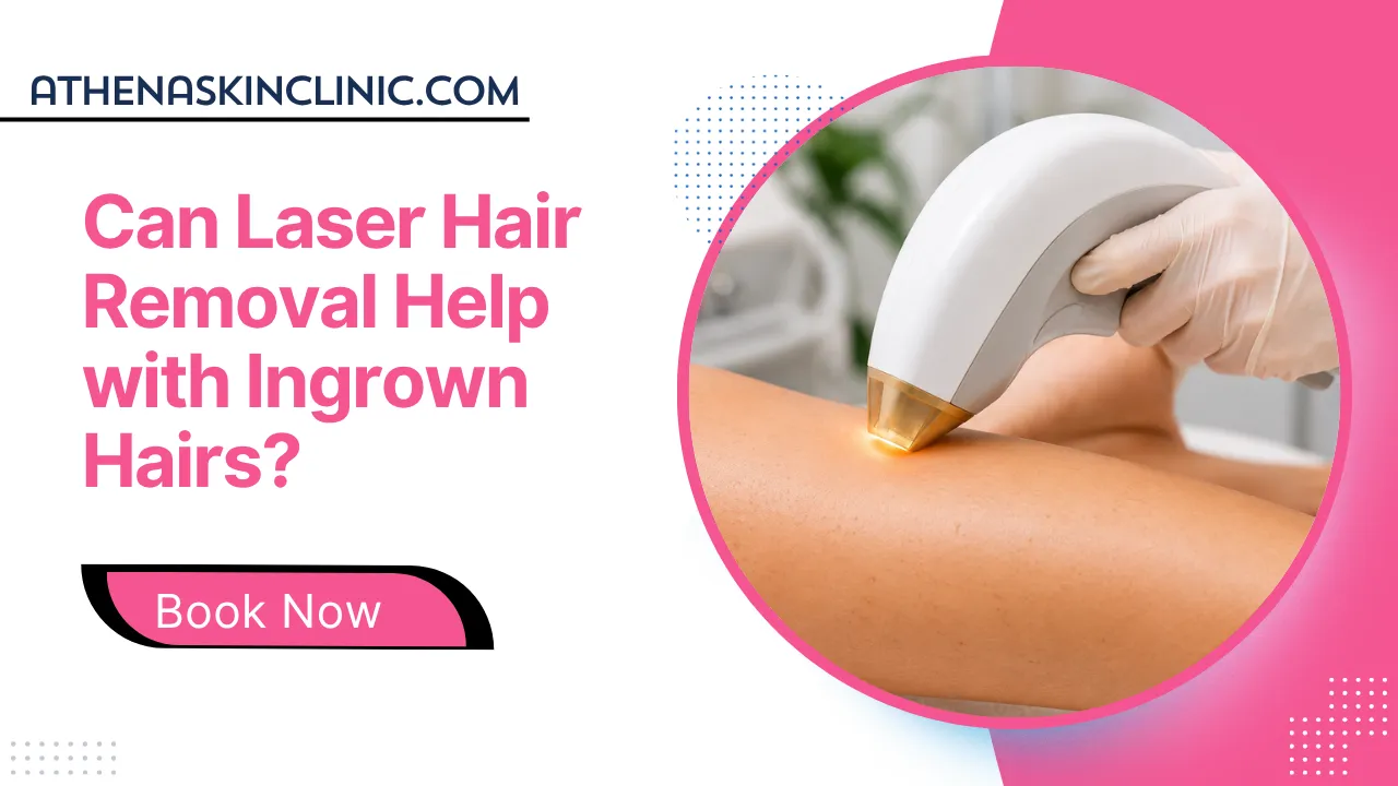 can laser hair removal help with ingrown hair featured image
