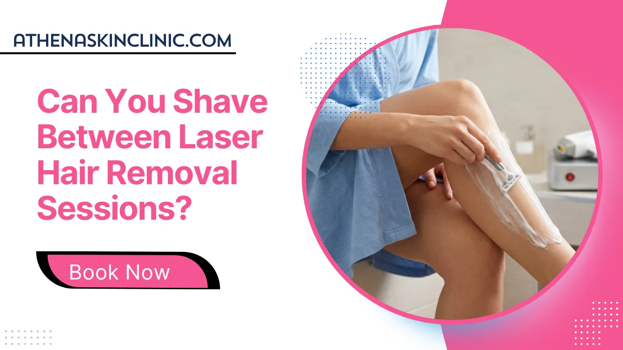 can you shave between laser hair removal sessions